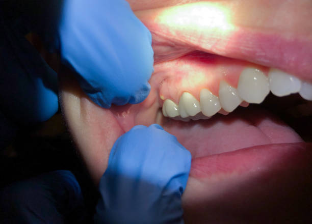 Best Cracked Tooth Emergency Dentist  in , IA
